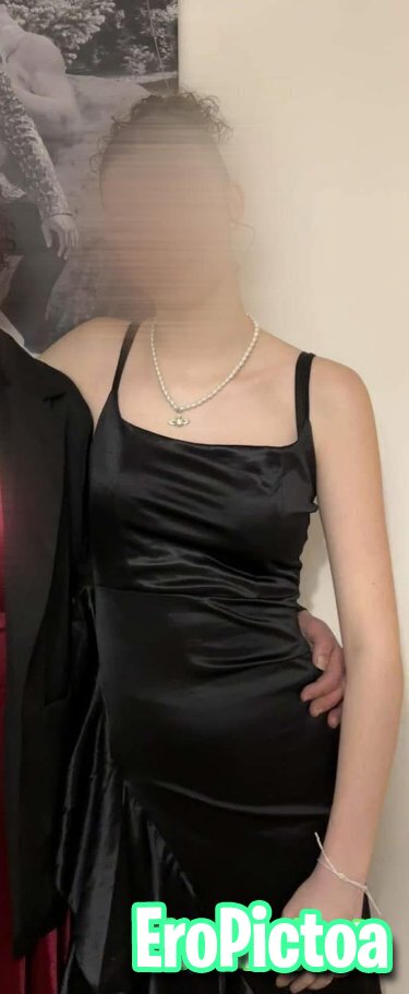 Cecilya goon fuel photo featuring braces