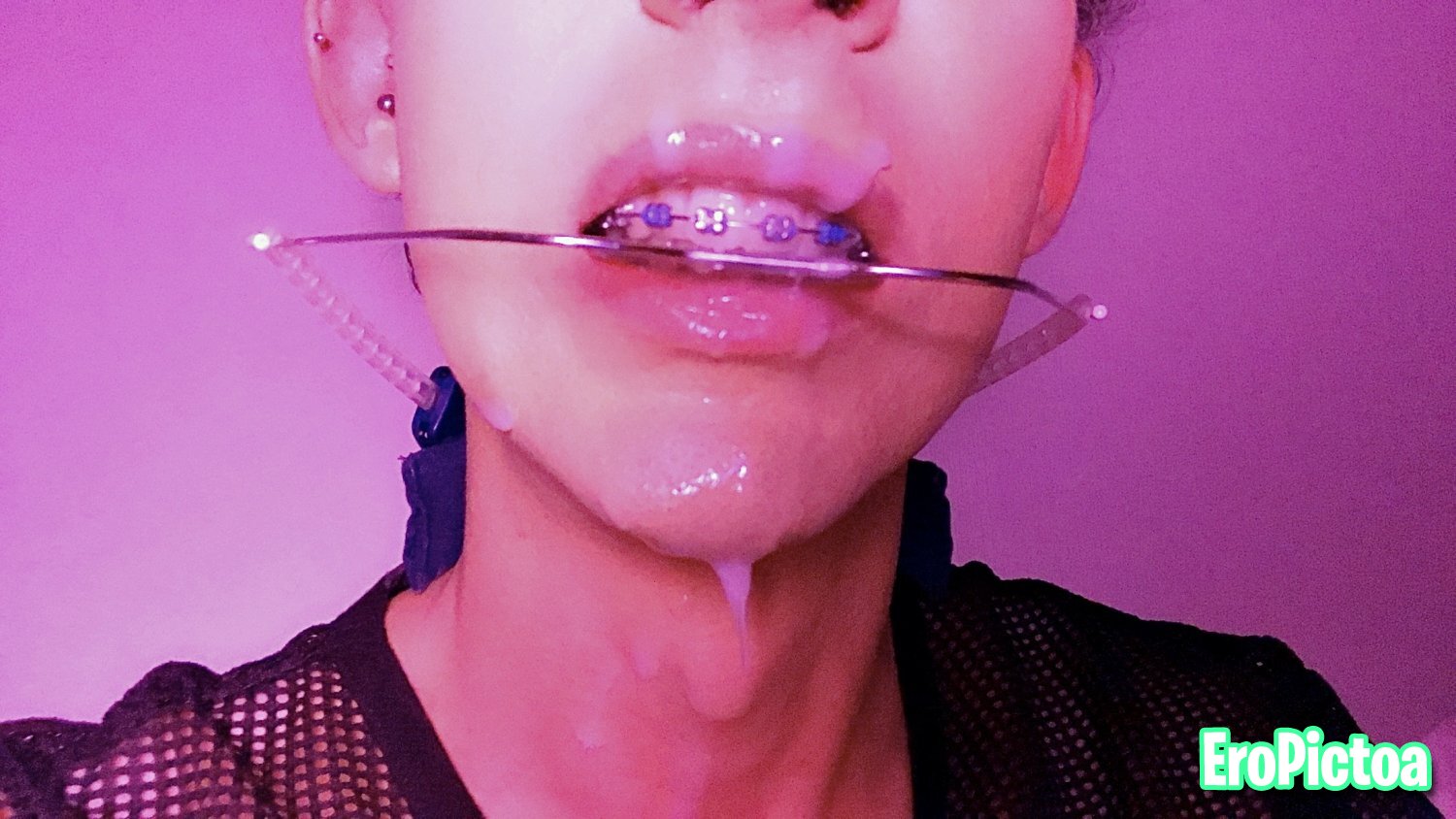 Braceface gooner photo featuring exposed - Part 13