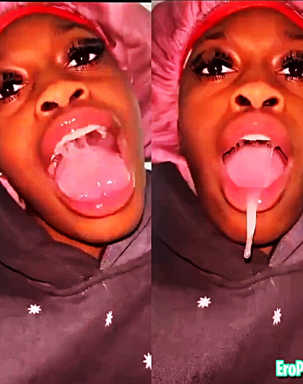 Thumbnail for spitty DSL braceface 😮‍💨