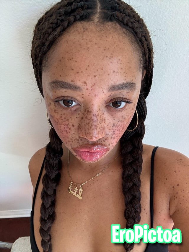 S@ļëm Mīțçħêļļ 💦 photo featuring facial