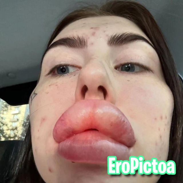 Russian DSL Goon Fuel 2 photo featuring fake lips - Part 23