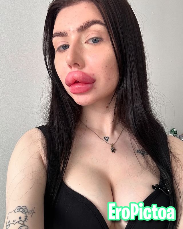 Russian DSL Goon Fuel 2 photo featuring fake lips - Part 47