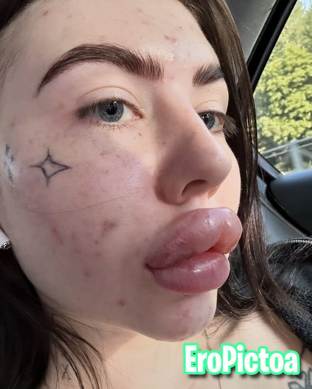 Russian DSL Goon Fuel 2 photo featuring huge lips - Part 15