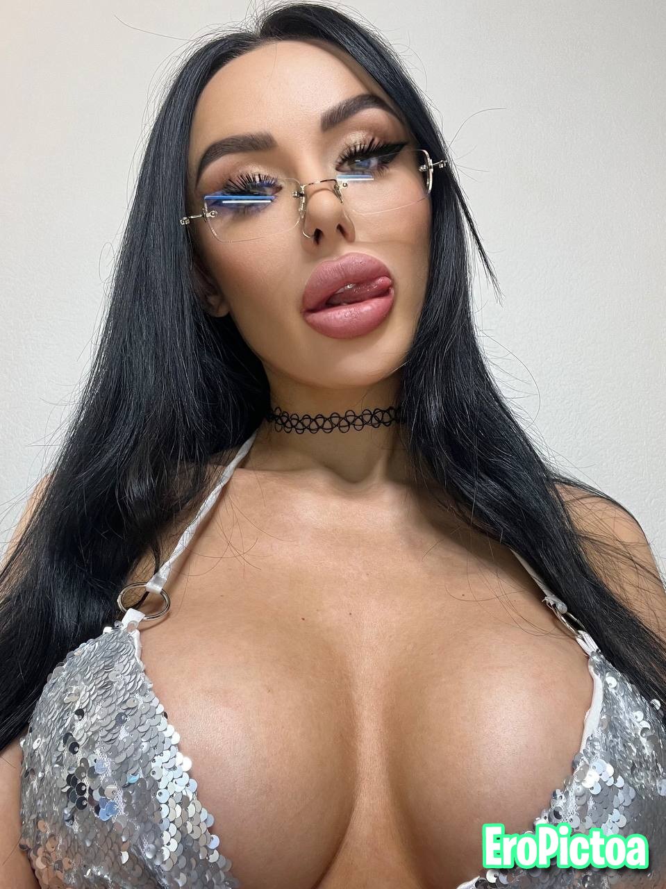 DSL Goon Fuel photo featuring lip fillers