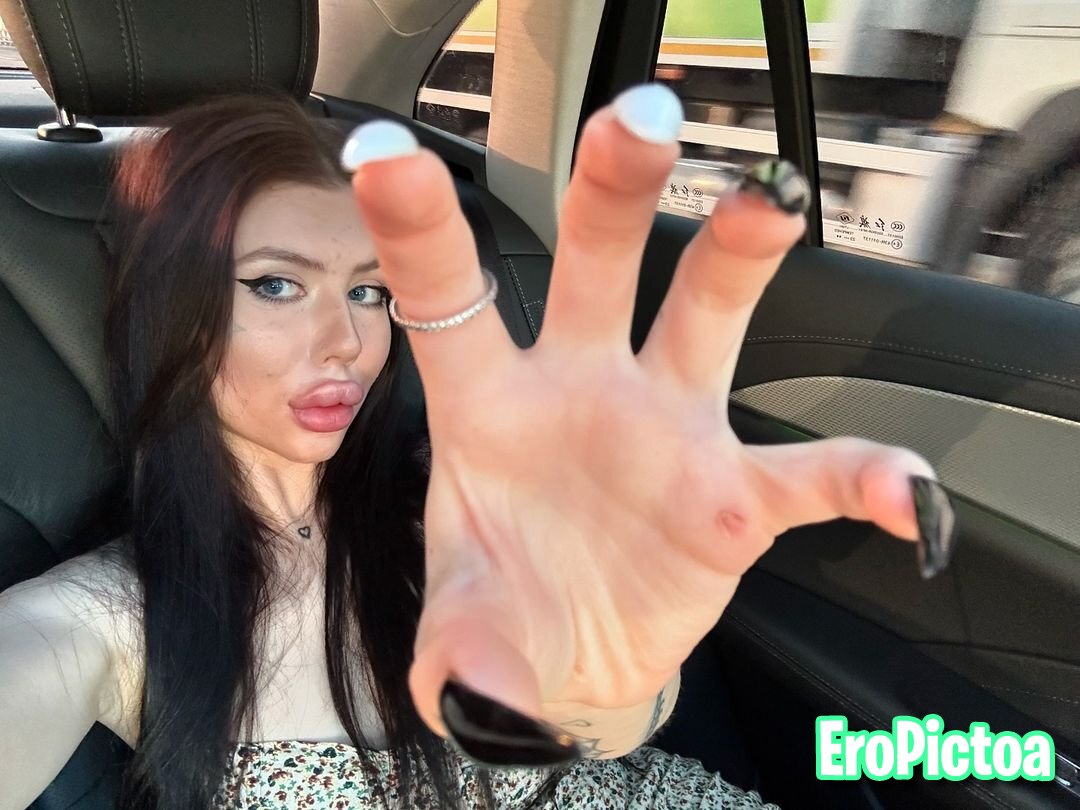 Russian DSL Goon Fuel photo featuring lip fillers