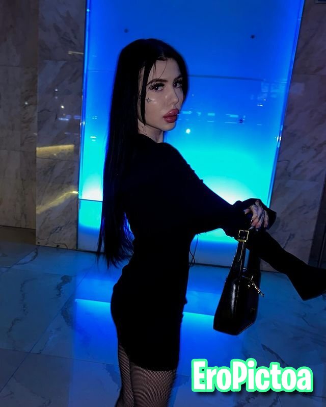 Russian DSL Goon Fuel photo featuring lip fillers