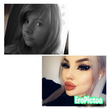 Pumped up DSLs photo featuring bimbo lips - Part 2