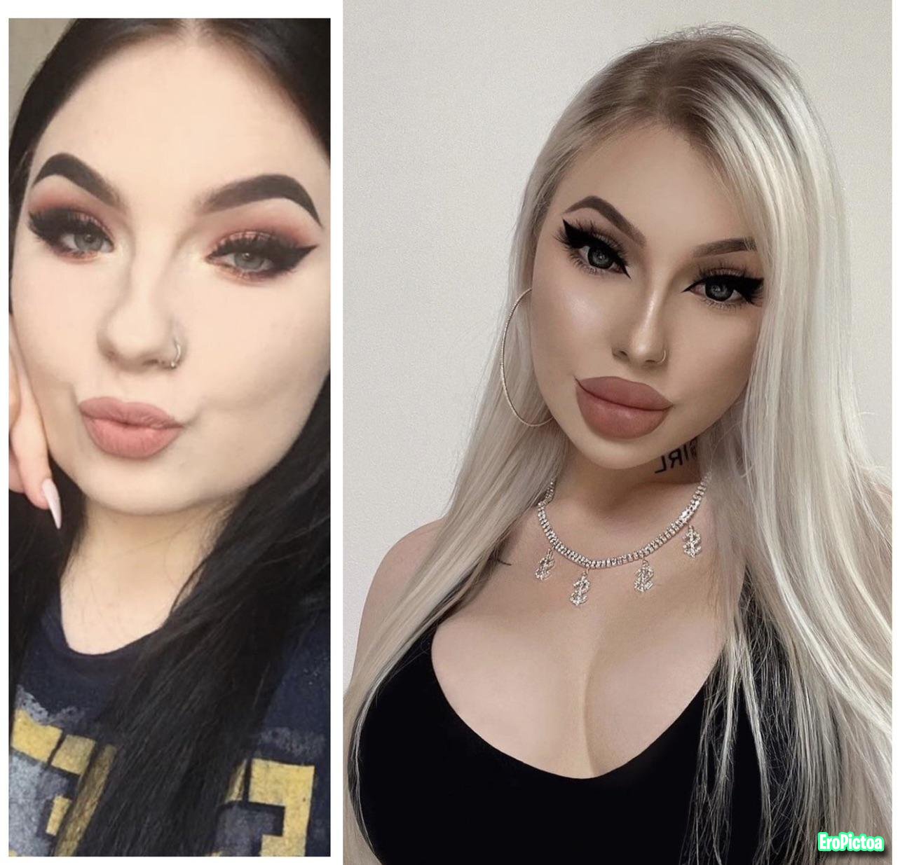 Pumped up DSLs photo featuring lip fillers - Part 6