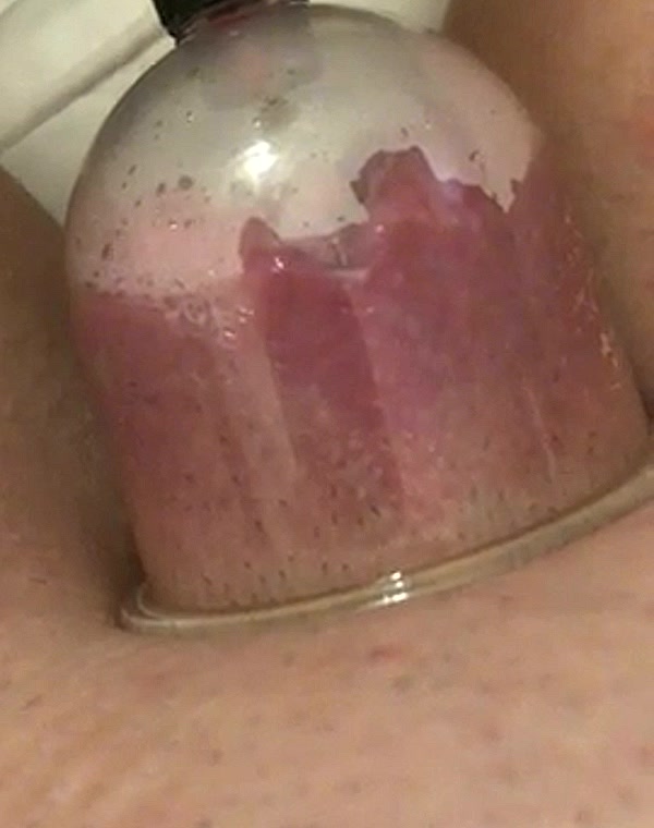 Thumbnail for Pumping session