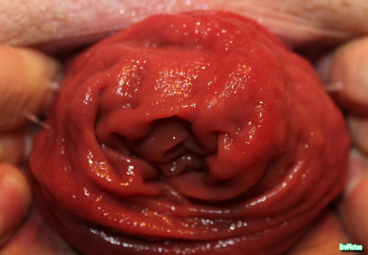 Rosebud closeup photo featuring rectum - Part 10