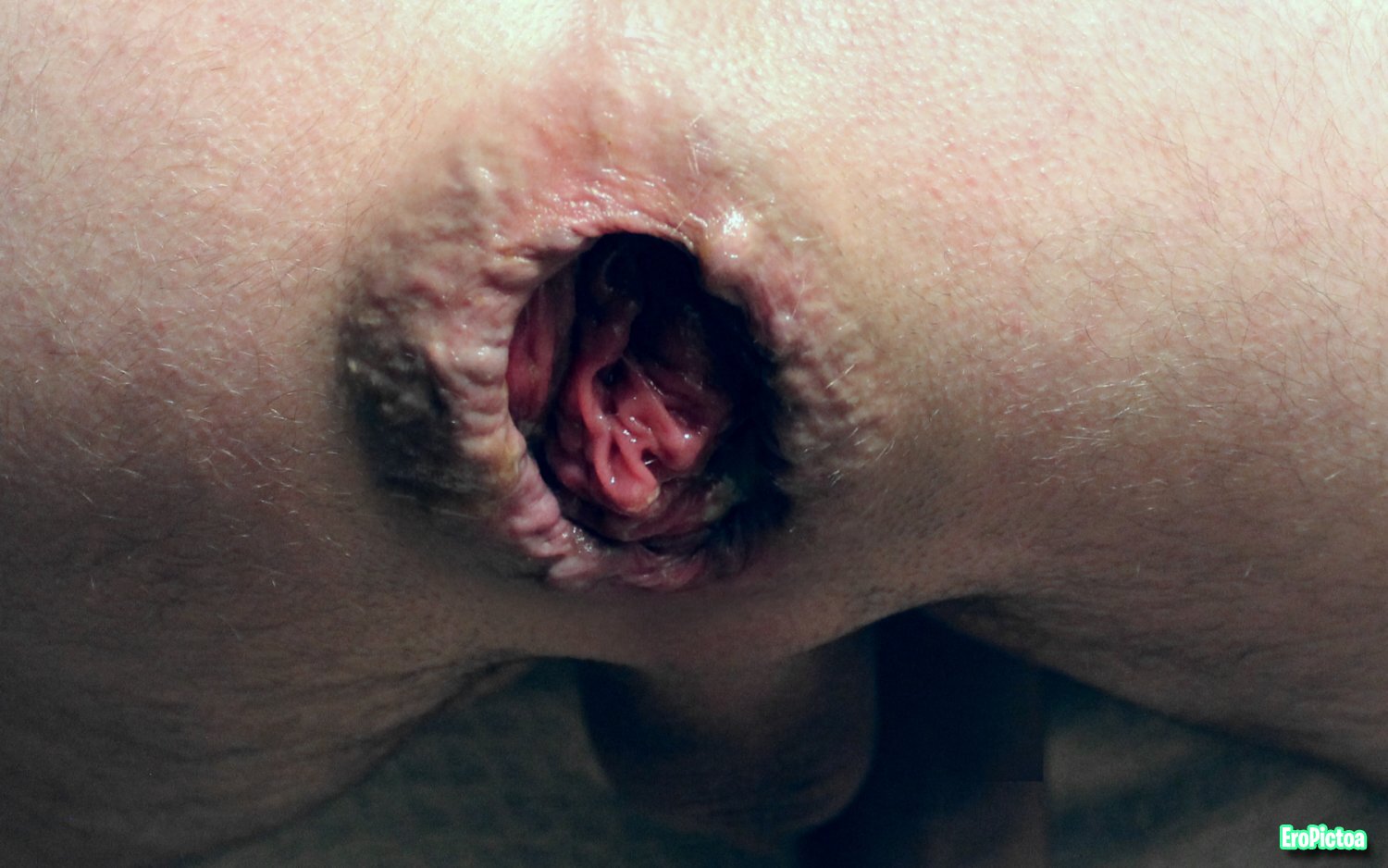 Prolapse art photo featuring anal - Part 16