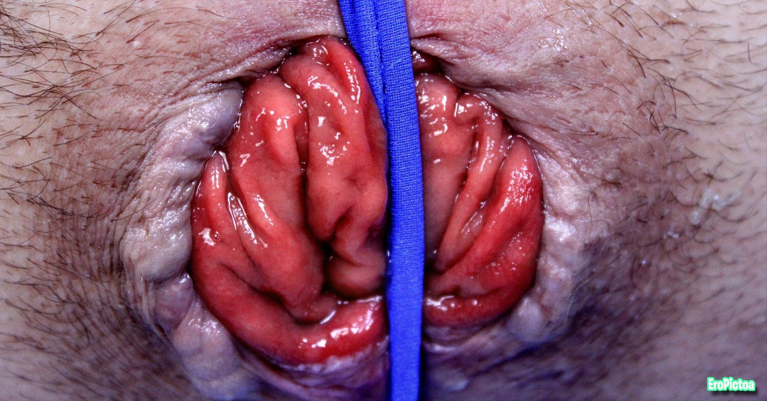 Prolapse art photo featuring extreme - Part 23