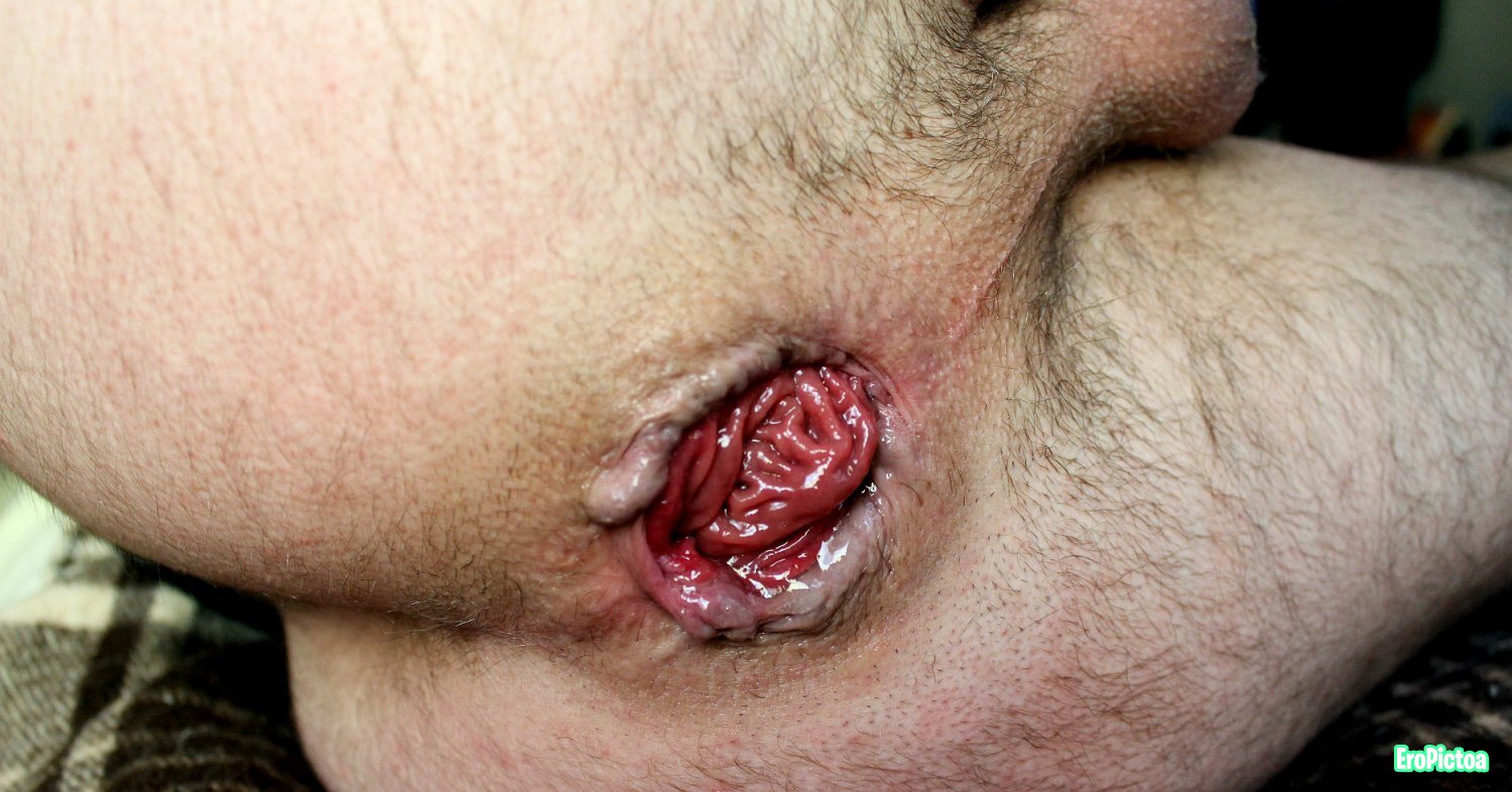 Prolapse art photo featuring BUTTEYES - Part 27