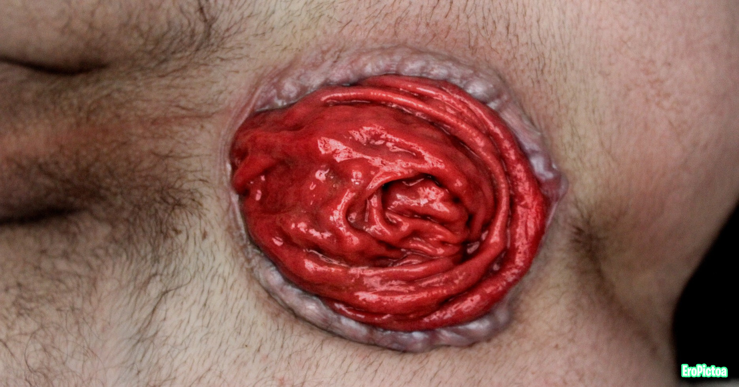 Prolapse art photo featuring extreme - Part 5